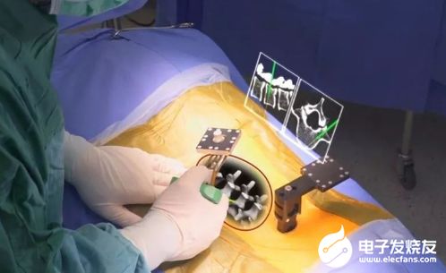 如何借助ar技術實現在醫療領域的充分利用