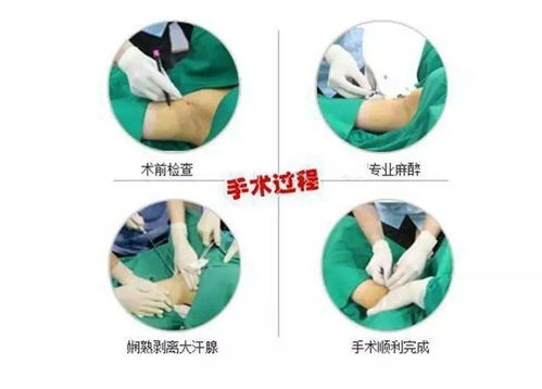 它讓你害怕坐車 約會 工作,你還不行動嗎