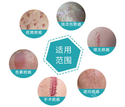 北京京城皮膚醫院可靠嗎?北京京城醫院是._整容問答