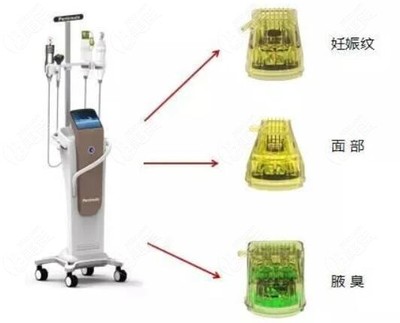 黃金微針4.0治療腋臭 次數(shù)與維持時(shí)間解析