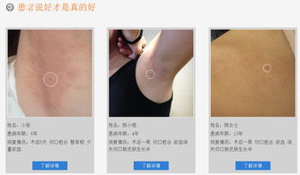 青島治療狐臭指南 方法與機(jī)構(gòu)推薦